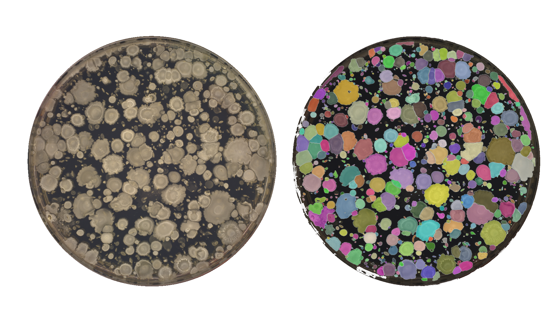 Food safety microbial plate with AI colony segmentation